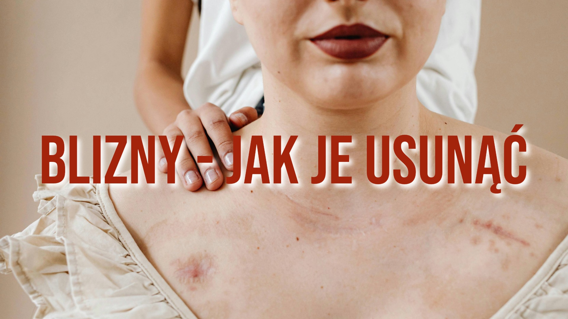 jak usunąć blizny