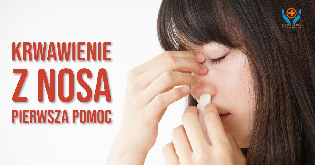 krwawienie z nosa