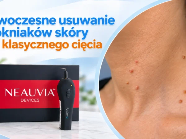 Usuwanie włókniaków plazmą IQ Neauvia w gabinecie dermatologicznym