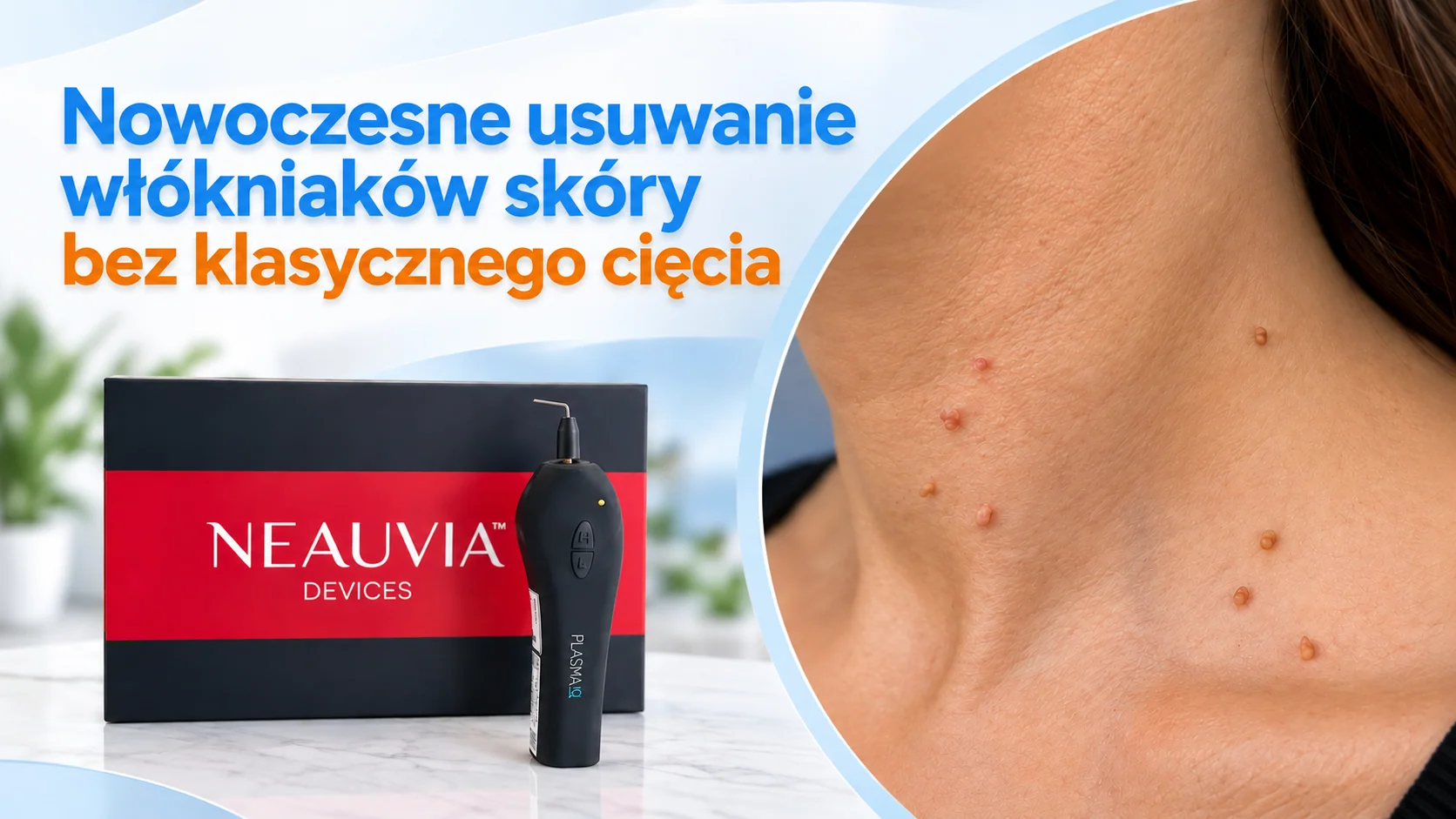 Usuwanie włókniaków plazmą IQ Neauvia w gabinecie dermatologicznym